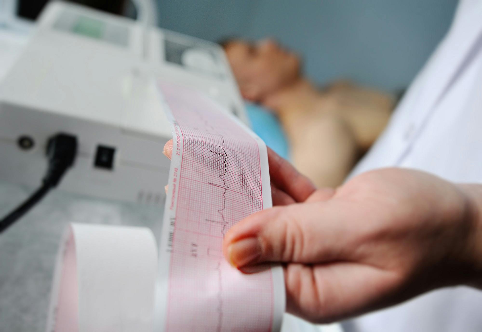 Patient im Krankenhausbett mit EKG-Monitor und Herzfrequenzdiagramm im Vordergrund.